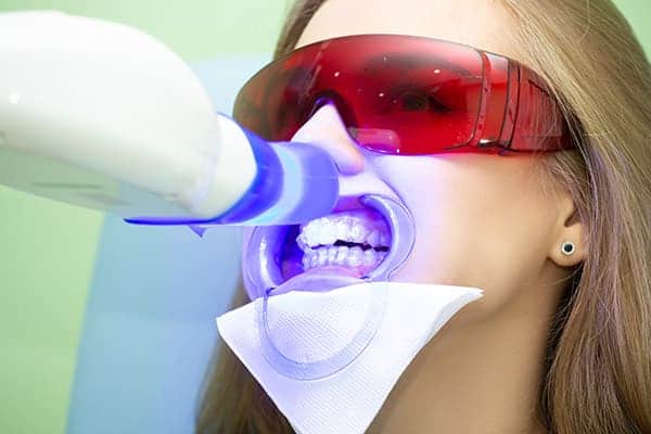 Laser teeth whitening treatments Wolverhampton