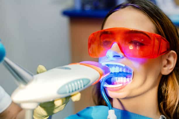 Simplifying Teeth Whitening: A Comprehensive Guide Wolverhampton