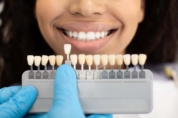 Laser Teeth Whitening: Exploring the Longevity of Your Brighter Smile Wolverhampton