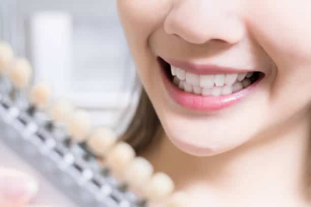 Teeth Whitening Kings Norton Wolverhampton