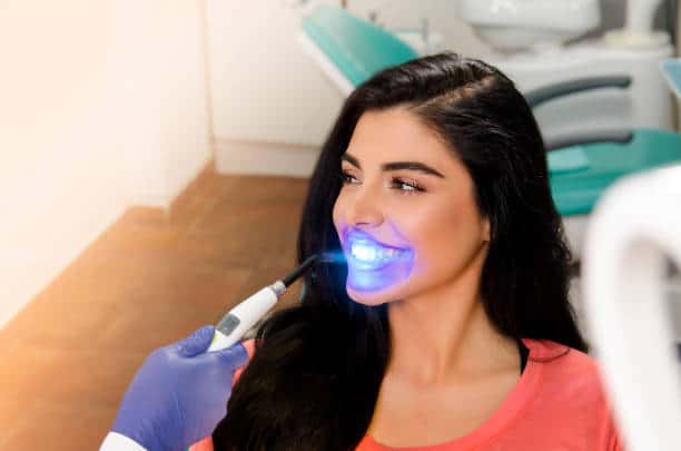 Top Teeth Whitening Systems for a Brighter Smile Wolverhampton