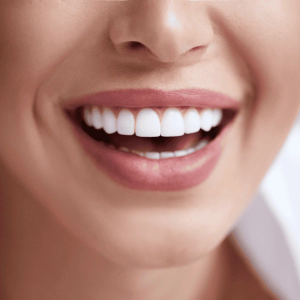 Get A whiter smile fast! Book with LA Teeth Whitening today! Wolverhampton